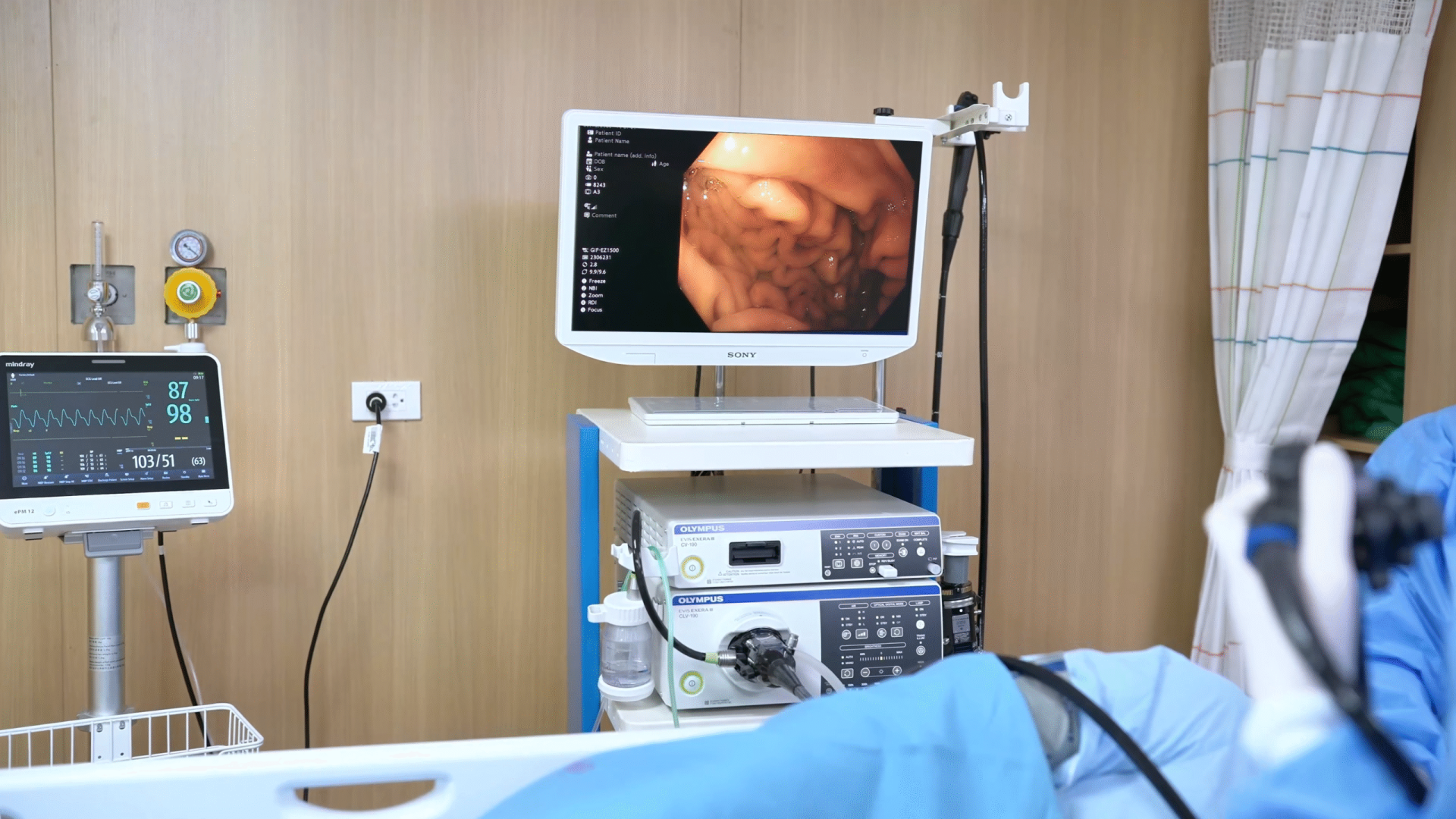 Nội soi dạ dày có đau không? Hình ảnh phòng nội soi và thiết bị hiện đại tại Bệnh viện Quốc tế Thăng Long Lạc Việt.