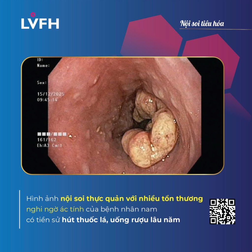 Khám sức khỏe định kỳ – “Phòng bệnh hơn chữa bệnh”