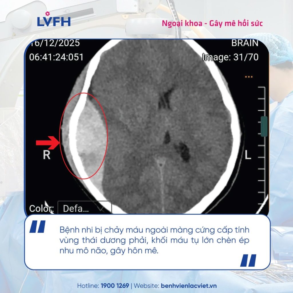 🚨 NGÃ XE ĐẠP, BÉ TRAI 11 TUỔI CHẤN THƯƠNG SỌ NÃO NGUY KỊCH, ĐƯỢC PHẪU THUẬT CẤP CỨU KỊP THỜI