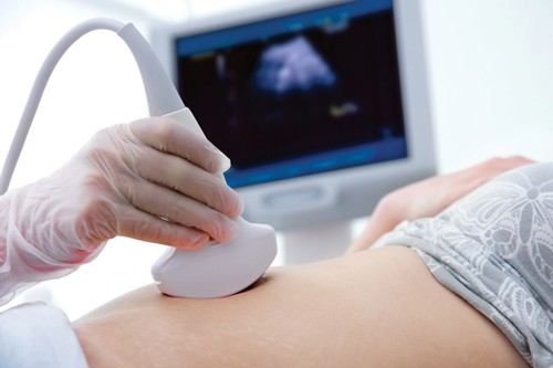 Có nên chọc ối xác định dị tật thai nhi không?