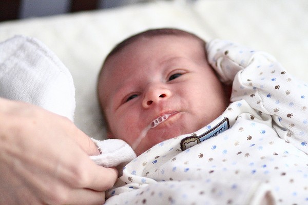 Nên làm gì khi trẻ sơ sinh bị trớ?