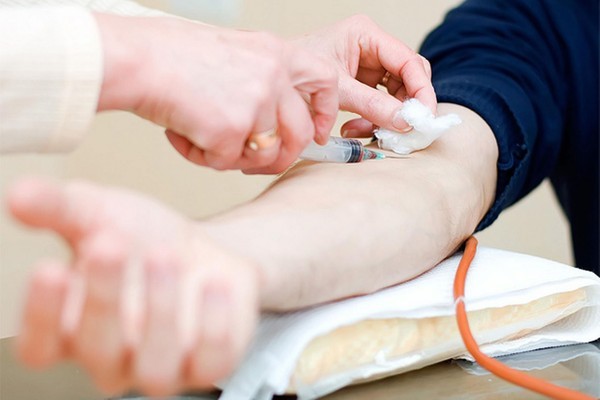 Nên làm những xét nghiệm gì khi khám sức khỏe tổng quát?