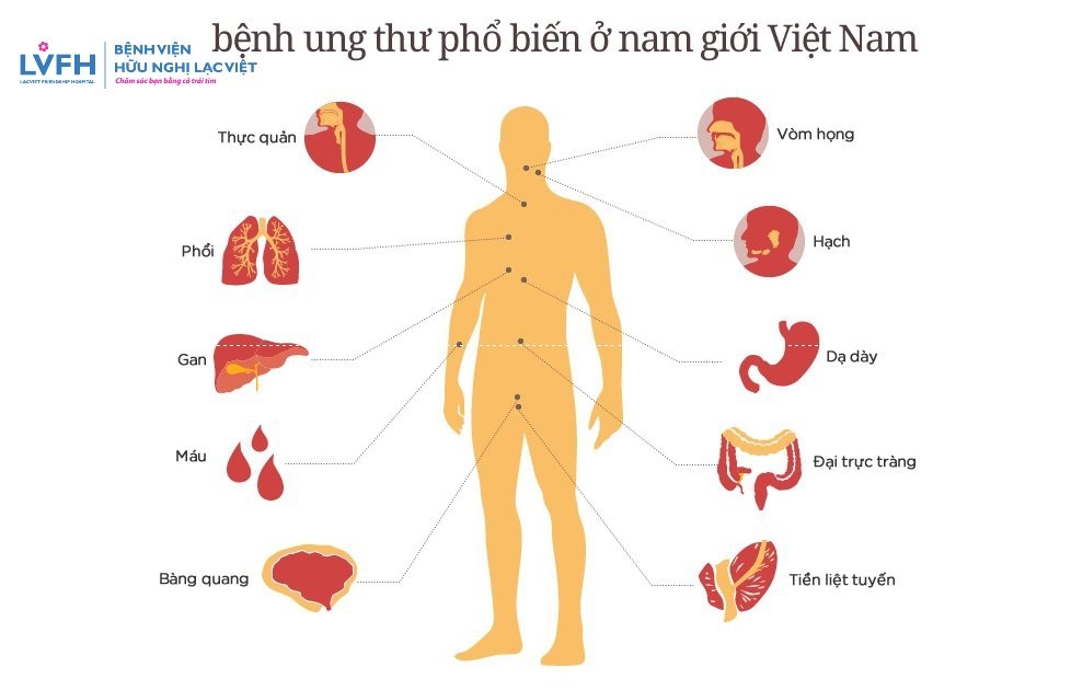 5 bệnh ung thư thường gặp ở nam giới