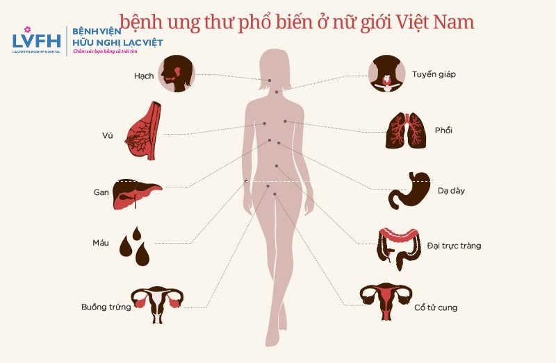 Ung Thu O Phu Nu Vn