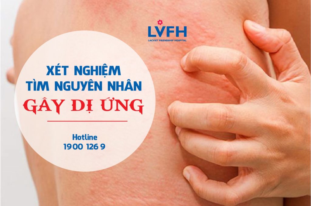 XÉT NGHIỆM 53 DỊ NGUYÊN GIÚP TÌM NGUYÊN NHÂN GÂY DỊ ỨNG