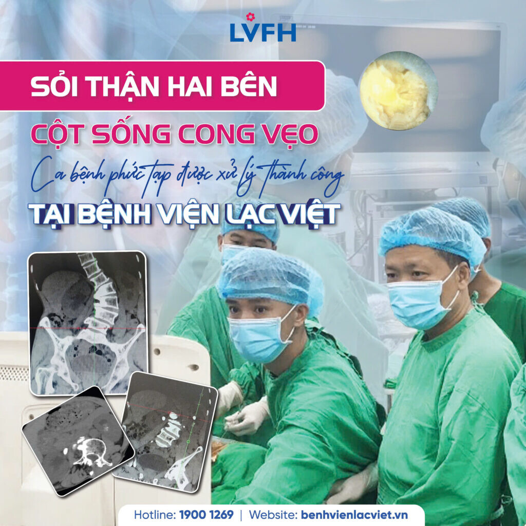 🚨 Sỏi thận hai bên, cột sống cong vẹo: Ca bệnh phức tạp được xử lý thành công tại Lạc Việt 1 z7691035029253 b765baa143d9f74023bf7fb9ca7074bf 1024x1024 1