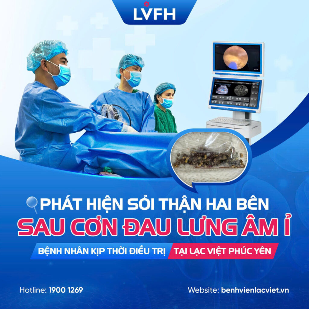 PHÁT HIỆN SỎI THẬN HAI BÊN SAU CƠN ĐAU LƯNG ÂM Ỉ – BỆNH NHÂN KỊP THỜI ĐIỀU TRỊ TẠI LẠC VIỆT PHÚC YÊN