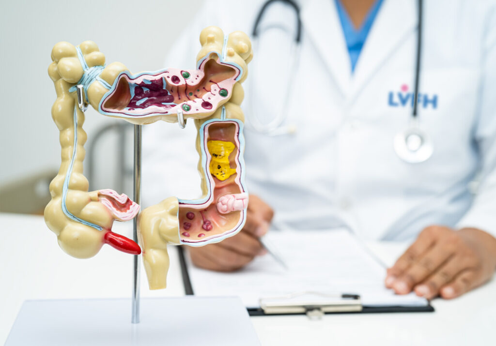 Chuyên gia Việt Đức – Gói Khám Và Nội Soi Đại Tràng