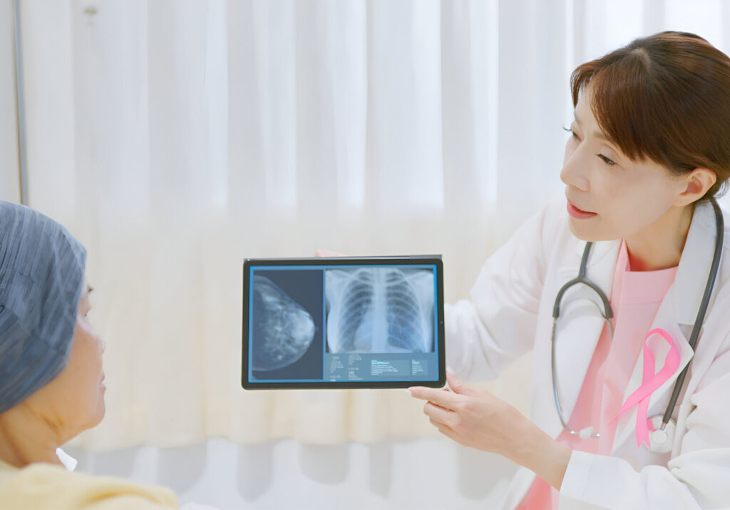 Gói Khám Tầm Soát Toàn Diện Ung Thư Vú